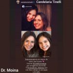 Candelaria Tinelli - Rinoplastia - Dr. Moina.